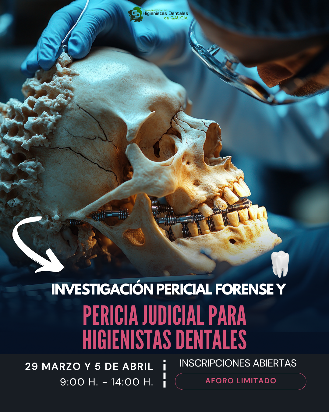 Investigación Pericial Forense y Pericia Judicial para Higienistas Dentales